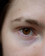 Digital Eye Strain. (Image via Pexels)